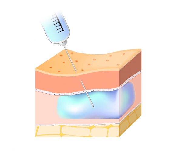 dfa7180699ac55c2c1e67b58e3dd8302_1786676251_5833.png